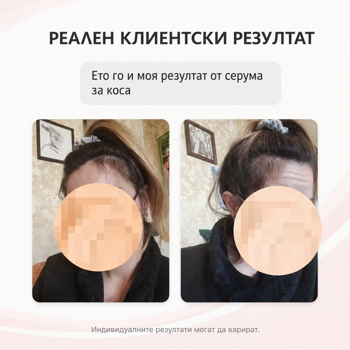     Видимо по-плътна коса след употреба на шампоан за растеж и плътност