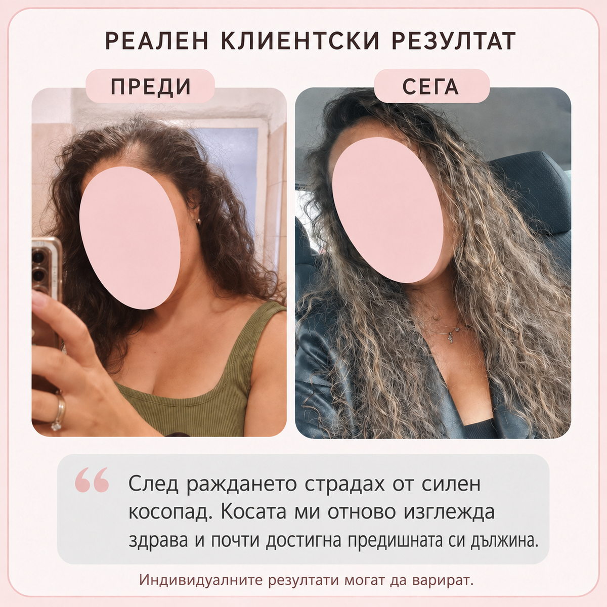     Реален резултат преди и след употреба на серум за растеж на косата Glowing Essence
